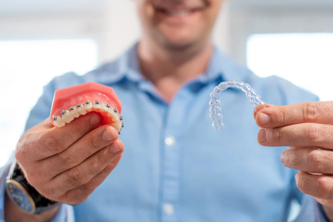 Clear Aligners VS Braces – Which Is Better?