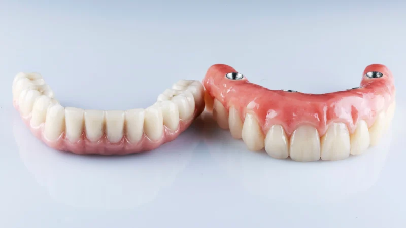 Dentures vs. Implants: Crafting Your Perfect Smile in Turkey