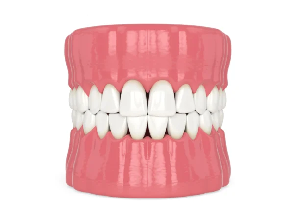 Receding gums: causes and Treatment