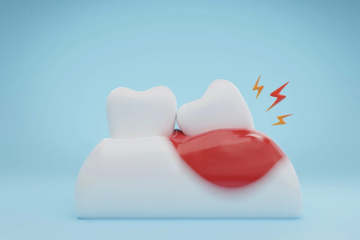 Dental Infection Treatment: Everything You Need to Know
