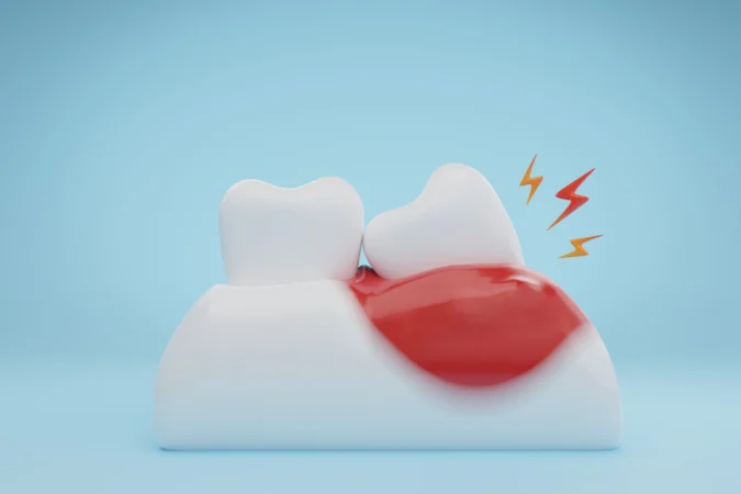 Dental Infection Treatment: Everything You Need to Know
