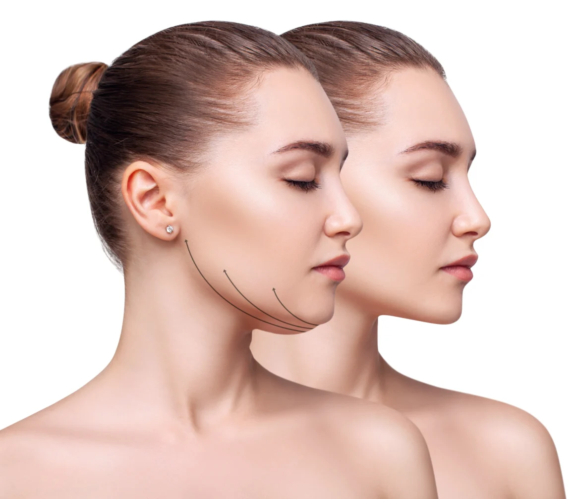 Jaw Surgery