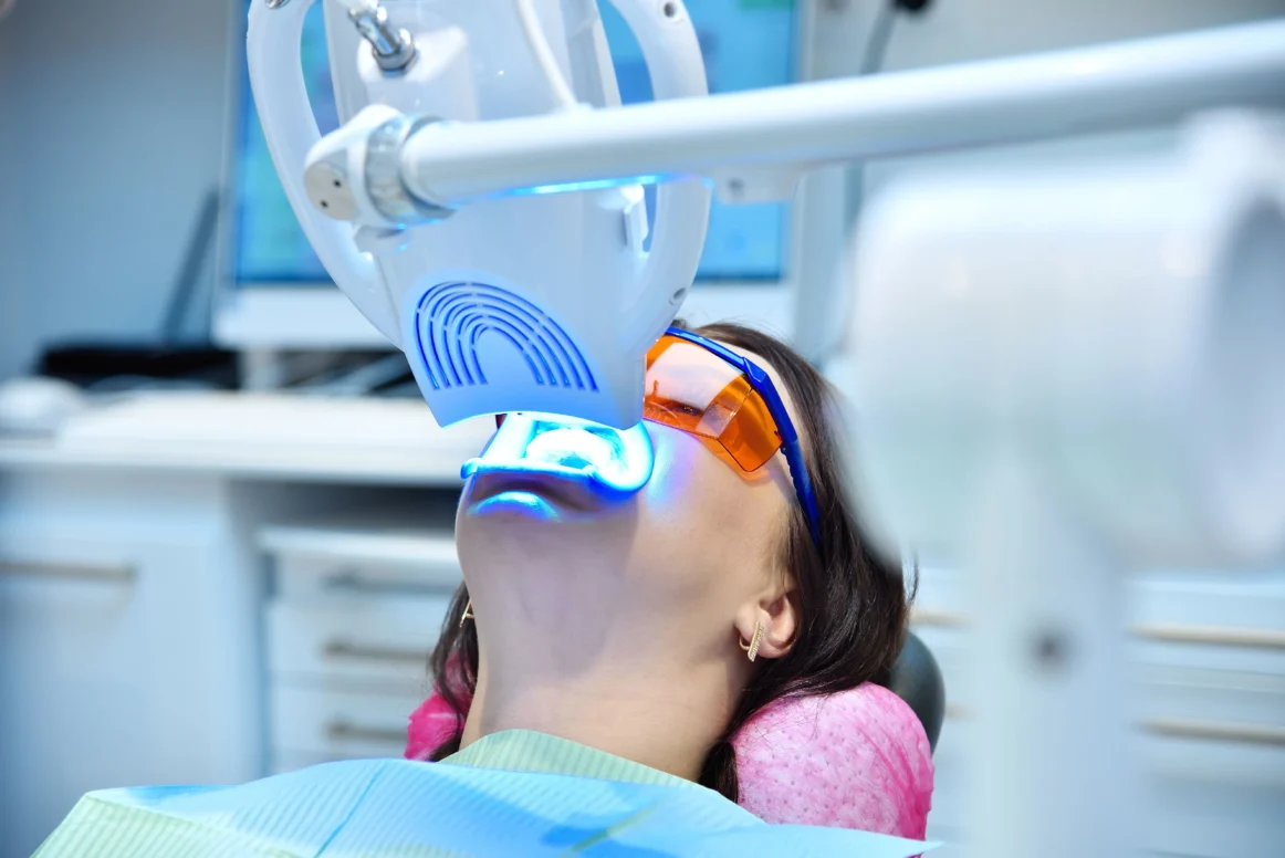 Teeth Whitening