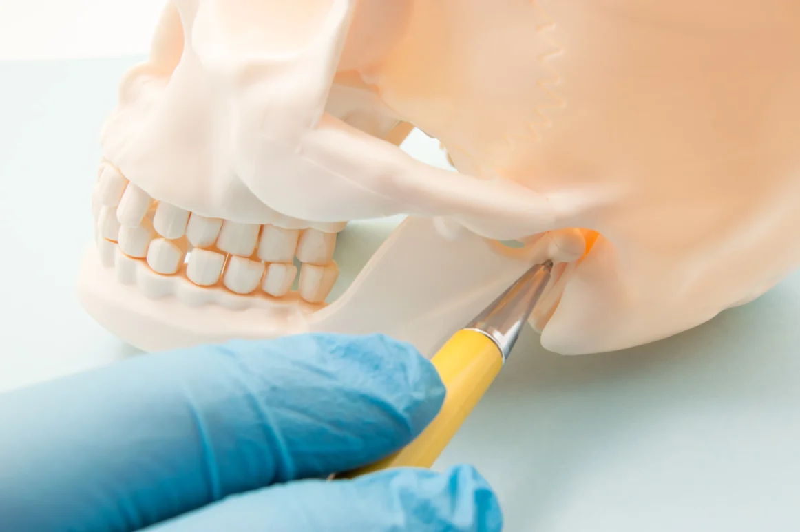 TMJ Treatment