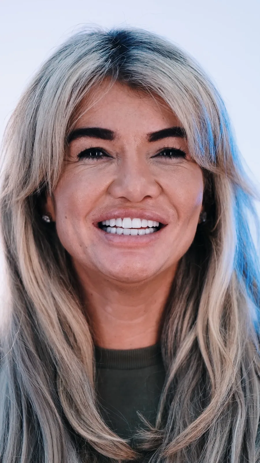 why-dentspa images