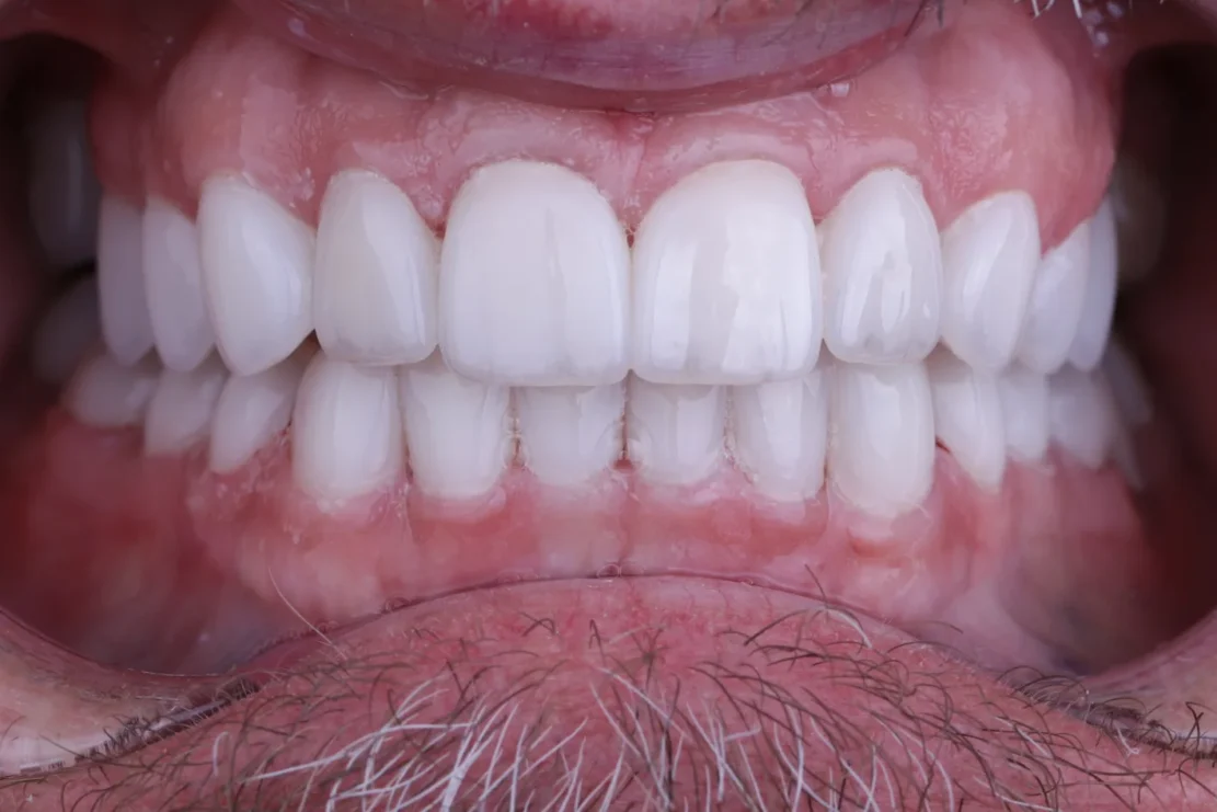 After Image