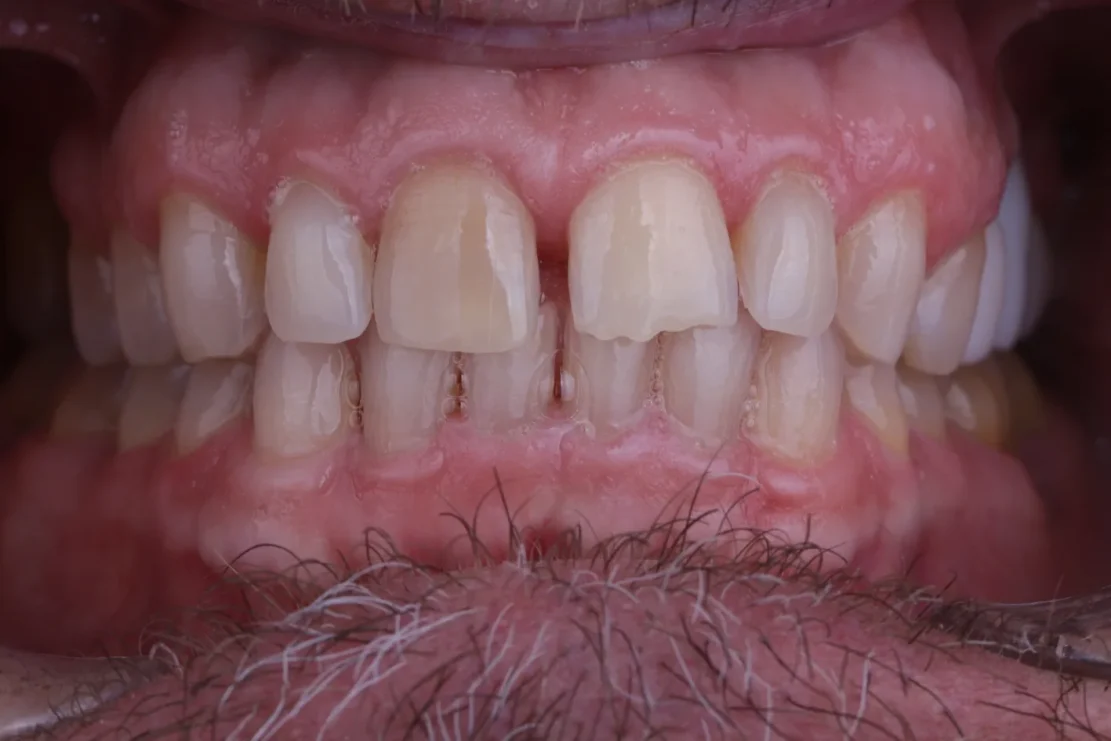 Before Image