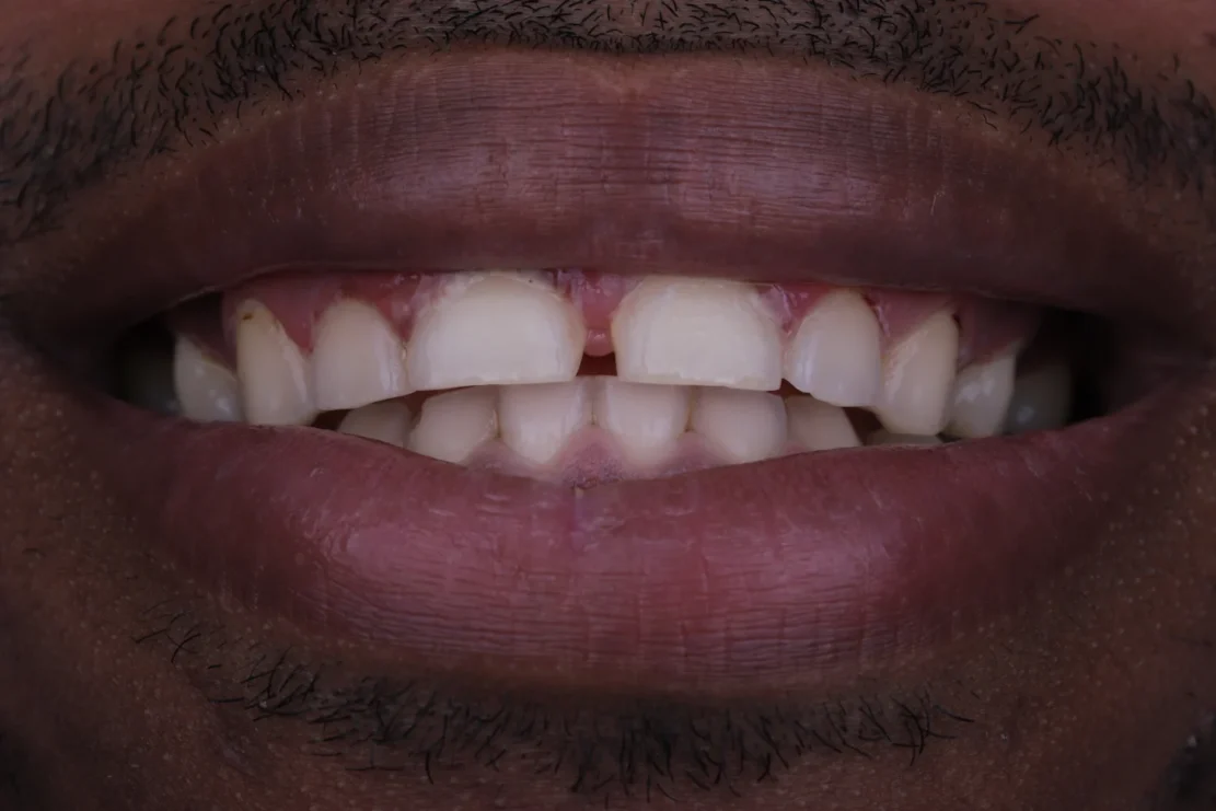 Before Image