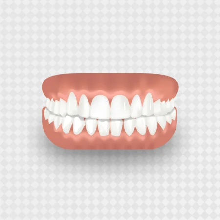 What is Deep Bite, And How Do You Treat It?