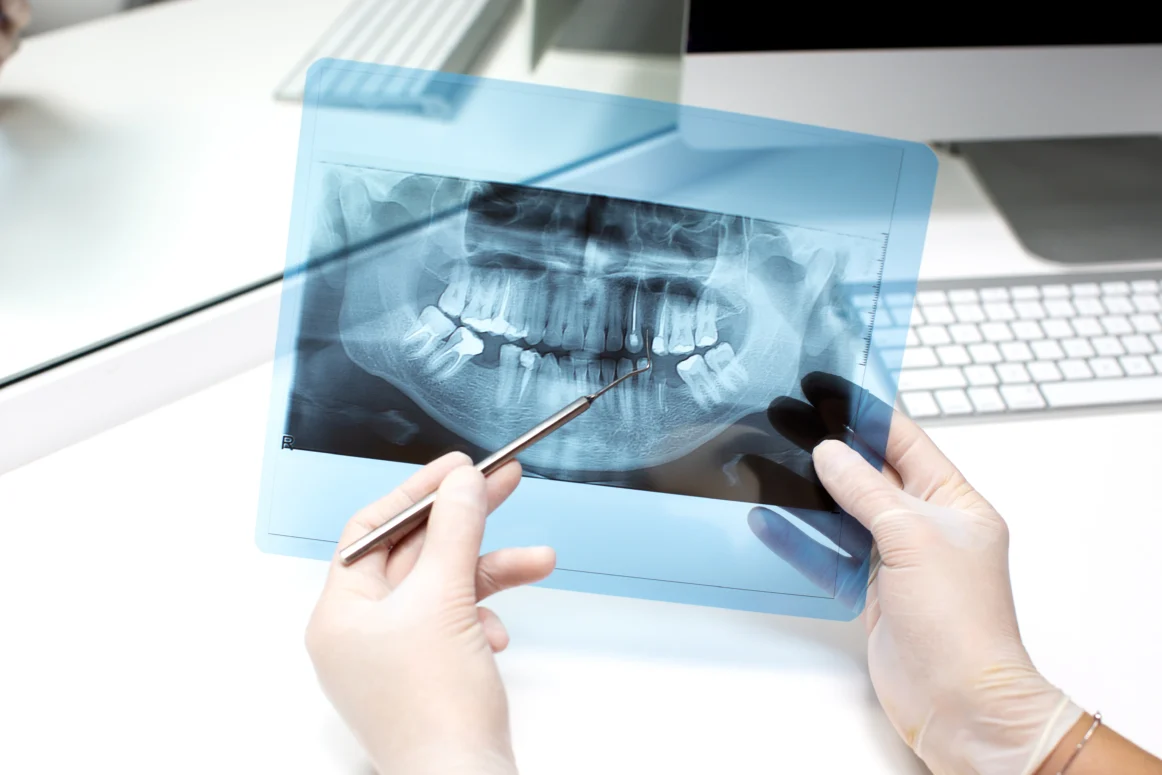 Toothache Trouble? Here’s How to Calm the Pain