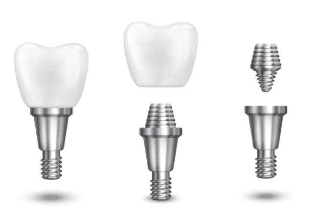 Dental Implants Cost in Turkey 2026: What Patients Really Pay and Why