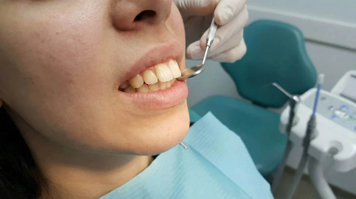 Buck Teeth: What They Are, How To Fix Them, and The Best Cosmetic Options For You