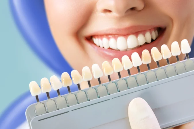 Veneers in Istanbul: Types, Process & What Your Smile Journey Looks Like at DentSpa