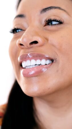 Smile Makeover: What’s Included, Full Cost Breakdown & US vs. Turkey (2026)
