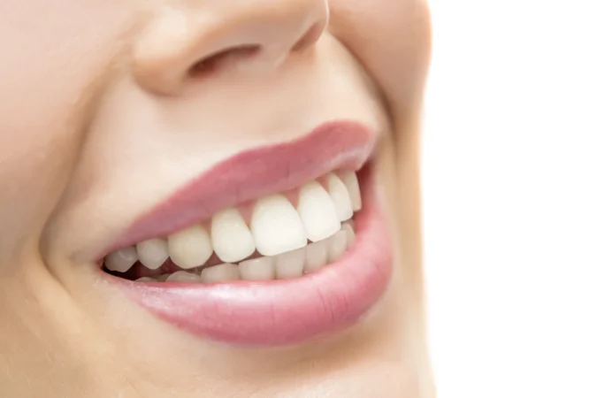 How to Straighten Teeth Without Braces