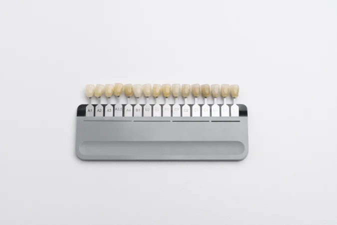 Non-Prep-Veneers: Für wen sie funktionieren