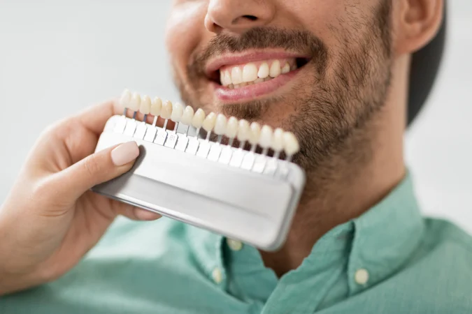 Veneers Kosten in Deutschland: Was Sie wirklich zahlen