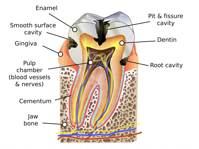 The layers of a tooth (enamel, dentin and pulp) and where cavities can form, including on the root. 