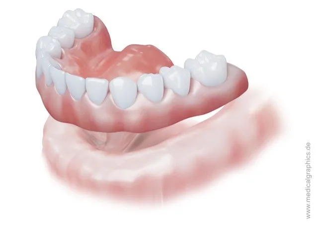 A complete denture for the lower jaw